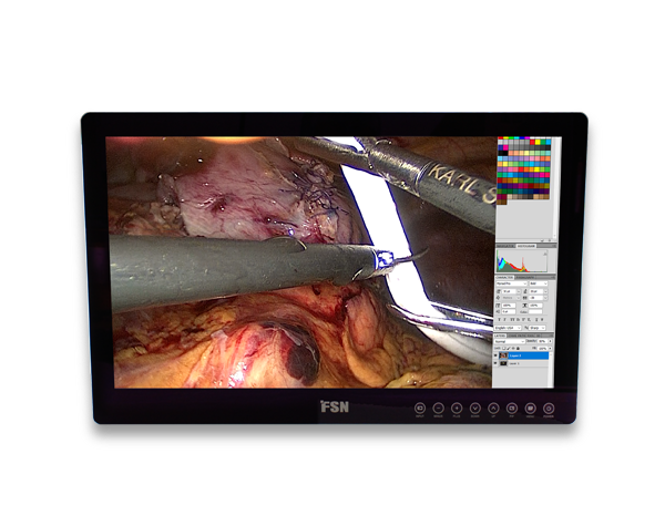FS-E2101DT 21.5″ HD Touch Medical Grade Monitor